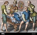 What Does Trepanning Do?