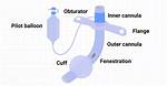 What Does Uncuffed Trach Mean?