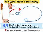 What Does Uroscopy Mean?
