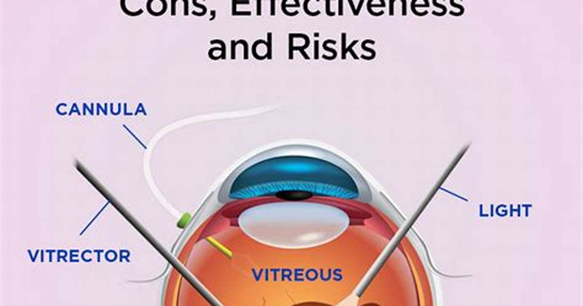 What Does Vitrectomy Mean?