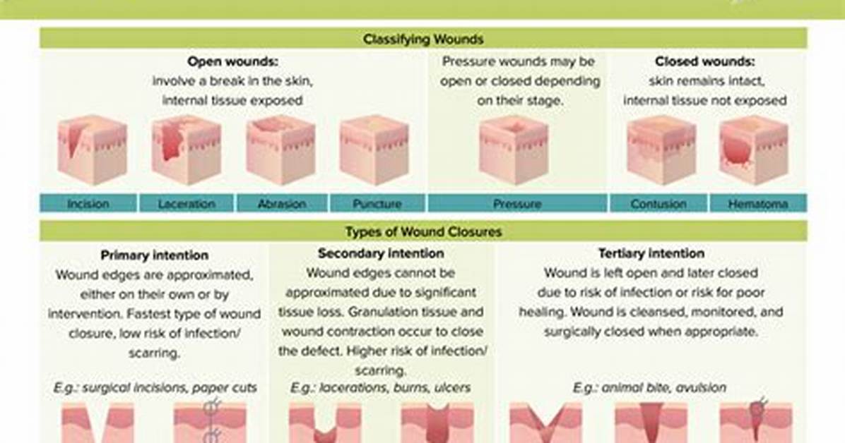 What Does Wound Mean Example?