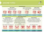 What Does Wound Mean Example?
