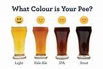 What Does Yellow Pee Mean