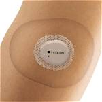What Is a Dexcom Patch