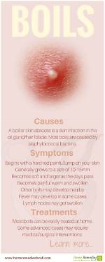 What Is a Risen Bump?