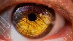 What Is Ametropia? and How Is It Treated?