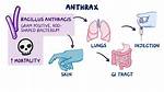 What Is Anthrax From