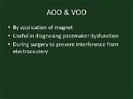 What Is Aoo Pacemaker