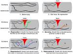 What Is Axonal Sprouting