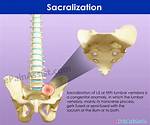 What Is Called Sacralization?