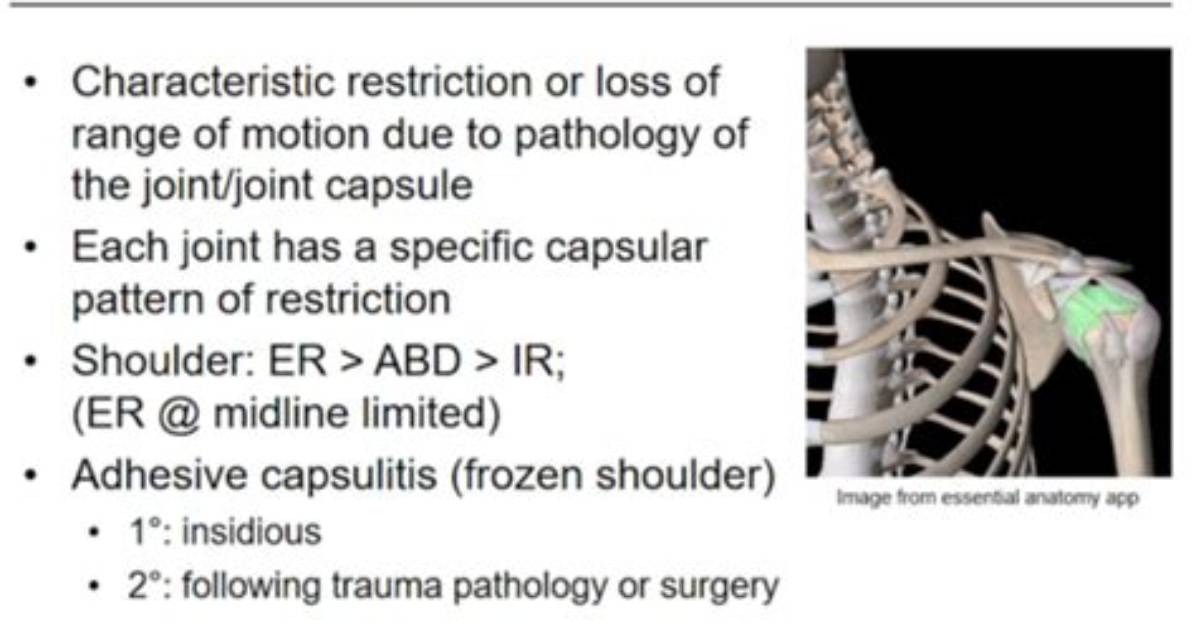 What Is Capsular Pattern