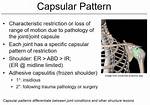 What Is Capsular Pattern