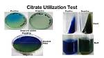 What Is Citrate Utilization Test