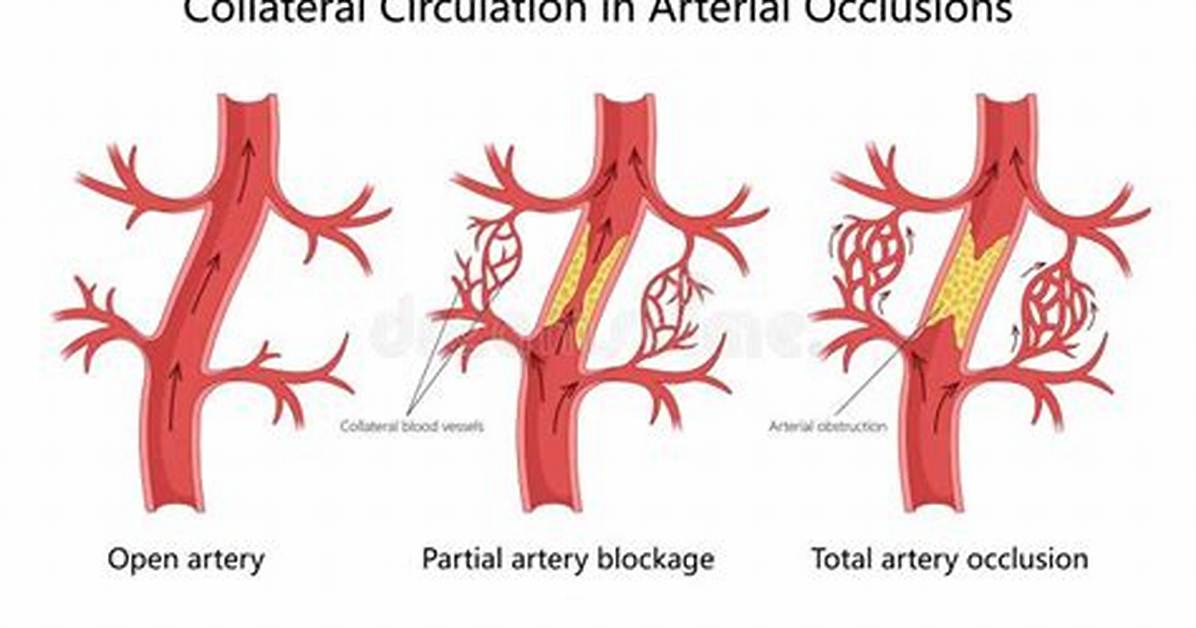 What Is Collateral Circulation?