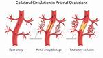 What Is Collateral Circulation?
