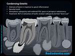 What Is Condensing Osteitis?