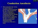 What Is Conduction Anesthesia? | Contextresponse. Com