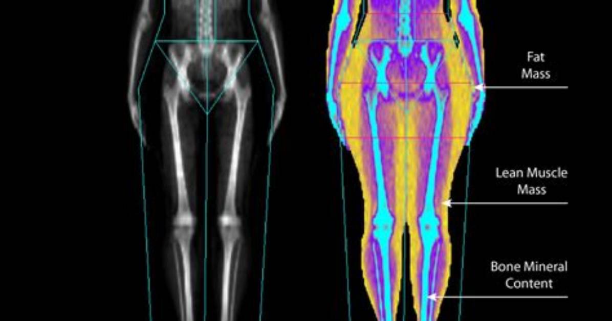 What Is Dexa Tech