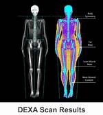 What Is Dexa Tech
