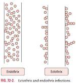 What Is Difference Between Ectothrix and Endothrix?