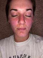 What Is Flushing