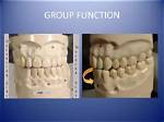 What Is Group Function Occlusion
