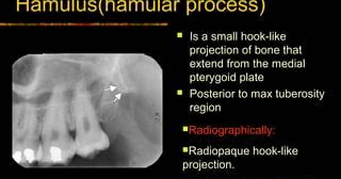 What Is Hamular Process?