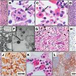 What Is Hematolymphoid? | Contextresponse. Com