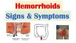 What Is Hemorrhoidal Attack?