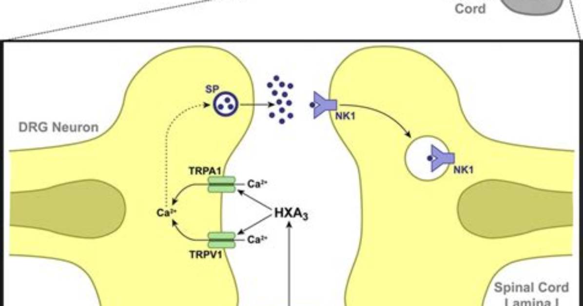 What Is Hyperalgesic Effects?