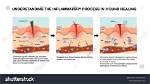 What Is Inflammatory Phase