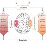 What Is Language Lateralization?