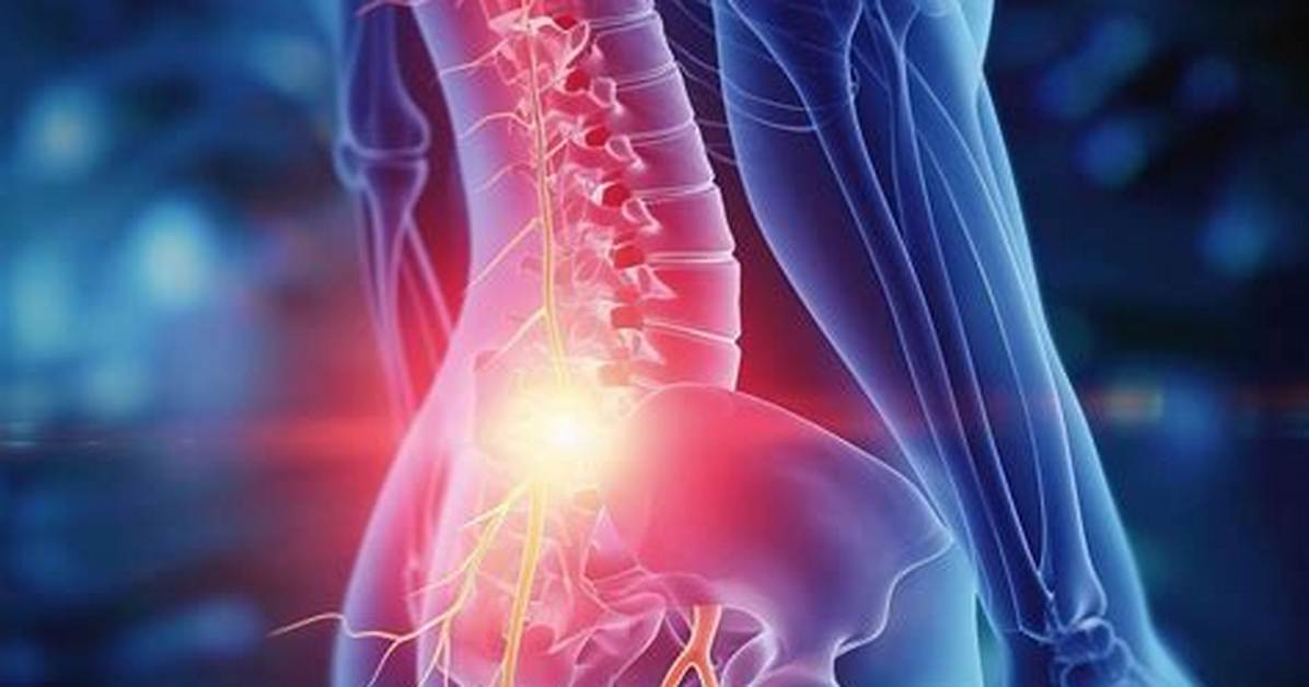 What Is Nerve Problem