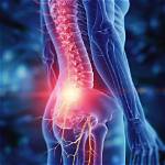 What Is Nerve Problem