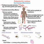 What Is Polyarteritis