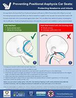 What Is Positional Asphyxia?