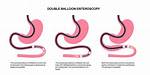 What Is Push Enteroscopy?
