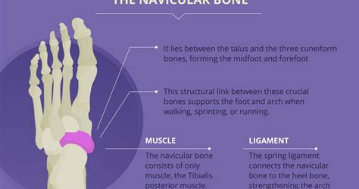 What Is Side Bone?