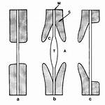 What Is Simple Pit Pair