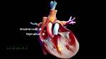 What Is Sinoatrial Node Dysfunction?