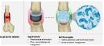 What Is Soft Bone?