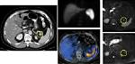 What Is Splenule? | Contextresponse. Com