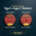 What Is the Difference Between Type 1 and Type 2 Second Degree Heart Block