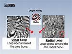 What Is the Difference Between Ulnar Loop and Radial Loop?