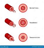 What Is Vasoconstriction