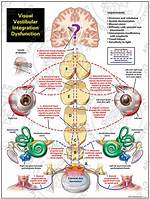 What Is Visual Vestibular Dysfunction?