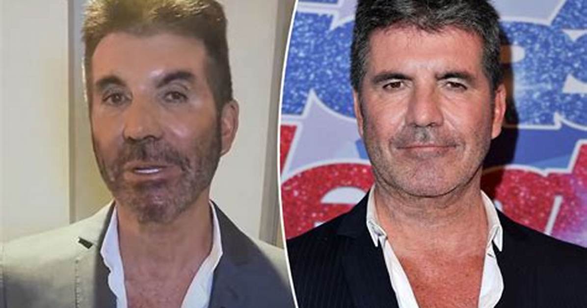 What Is Wrong with Simon Cowell's Son? a Comprehensive Analysis