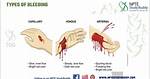 What Profuse Bleeding Mean?