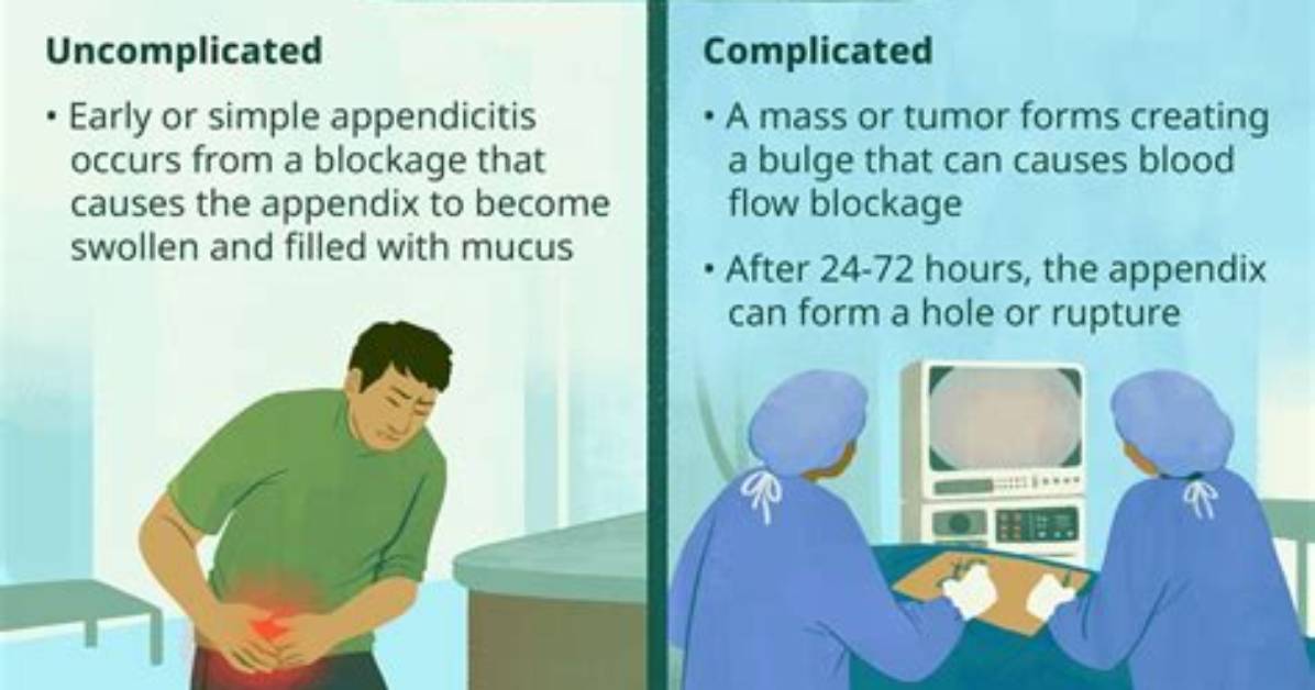 What Ruptures an Appendix?
