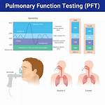 What's a Pulmonary Function Test?